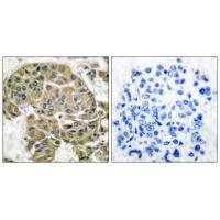 Mammaglobin B Antibody