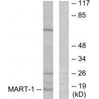 MART Antibody