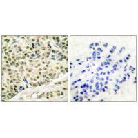 MCM2 Antibody