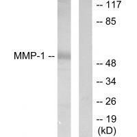 MMP Antibody