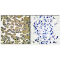 MMP1 Antibody