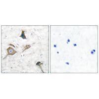 MMP6 Antibody