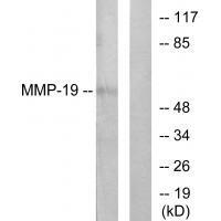 MMP9 Antibody