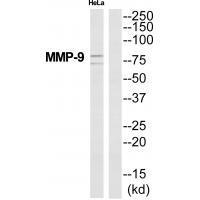 MMP-9 Antibody