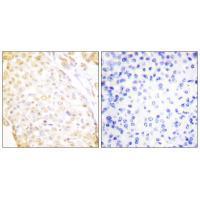 NKX3.1 Antibody