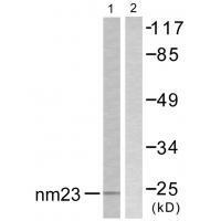 NM23 Antibody