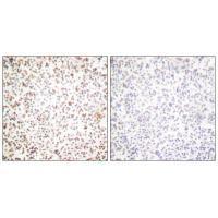 OCT1 Antibody