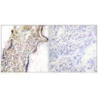 p14 ARF Antibody