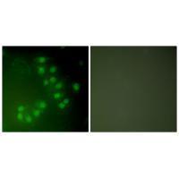 p63 Antibody