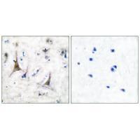 PGP9.5 Antibody