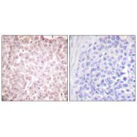 RCC1 Antibody
