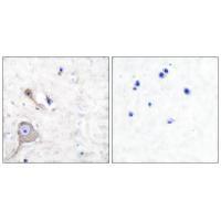 S100 A1 Antibody