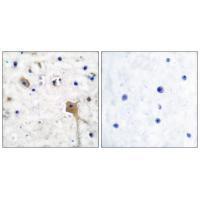 SH-PTP2 Antibody