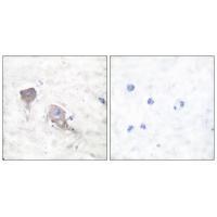 SNAP25 Antibody