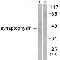 Synaptophysin Antibody