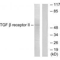 TGF β Receptor II Antibody