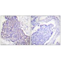 CD40 Antibody