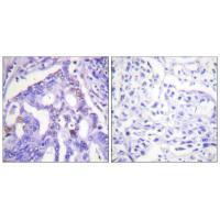 PIAS4 Antibody