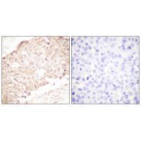 SENP1 Antibody