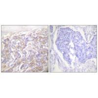 TNF Receptor Antibody