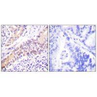Topoisomerase II β Antibody
