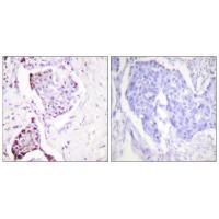 Ubiquitin Antibody