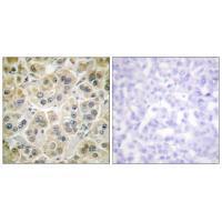 Vimentin Antibody