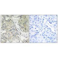 TM16J Antibody