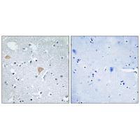CTRO Antibody
