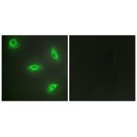 TNF14 Antibody