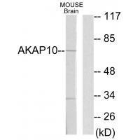 AKAP10 Antibody