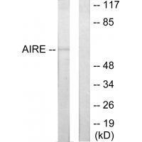 AIRE Antibody