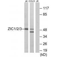 ZIC1/2/3 Antibody
