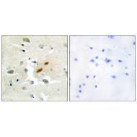 DNA Polymerase ζ Antibody