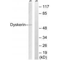 Dyskerin Antibody