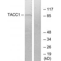 TACC1 Antibody