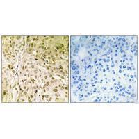DNA Polymerase θ Antibody