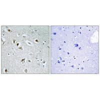 CDKA2 Antibody