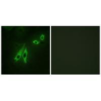 AKAP3 Antibody