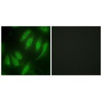 HEXIM1 Antibody