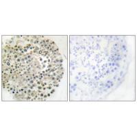 TRIM16 Antibody
