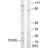 TFIP8 Antibody