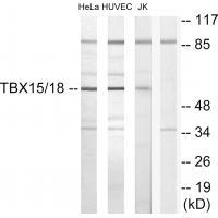 TBX15/18 Antibody