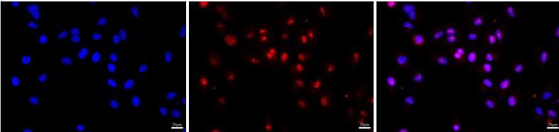 HAND1 Antibody