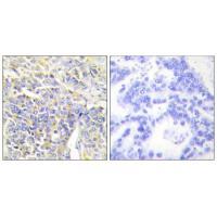 KAD1 Antibody