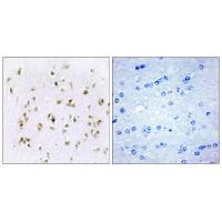 HMG17 Antibody