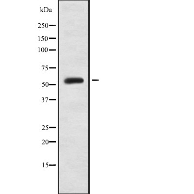 Heparin Cofactor II Antibody