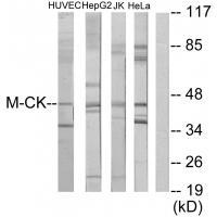 M-CK Antibody