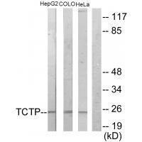 TCTP Antibody