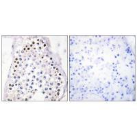 HOXA1/B1/D1 Antibody